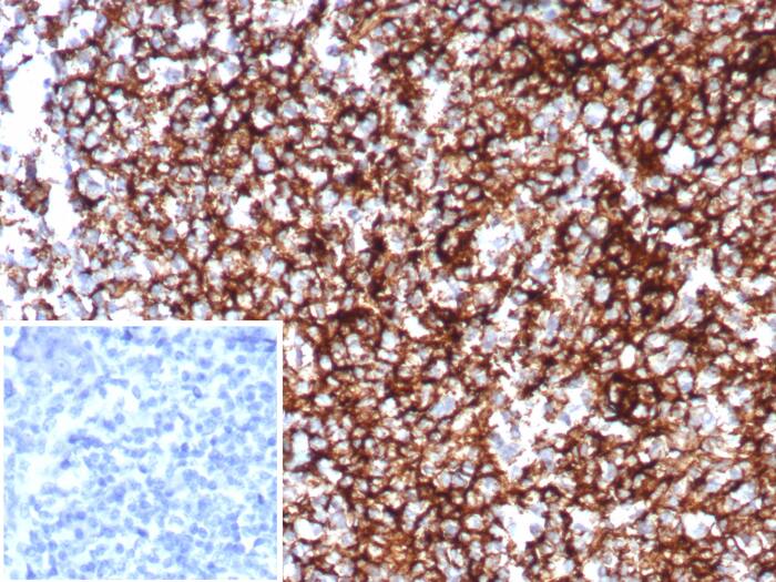 Formalin-fixed, paraffin-embedded human tonsil stained with CD35 antibody (CR1/8598R) - Azide and BSA Free. Inset: PBS instead of primary antibody; secondary only negative control.