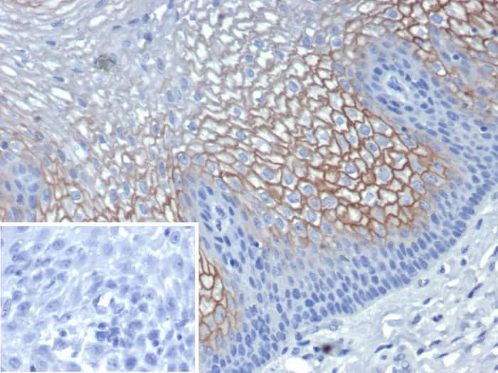 Immunohistochemistry-Paraffin: SBSN Antibody (SBSN/7961) - Azide and BSA Free [NBP3-24300] - Formalin-fixed, paraffin-embedded human esophagus stained with SBSN Antibody (SBSN/7961). HIER: Tris/EDTA, pH9.0, 45min. 2°C: HRP-polymer, 30min. DAB, 5min.