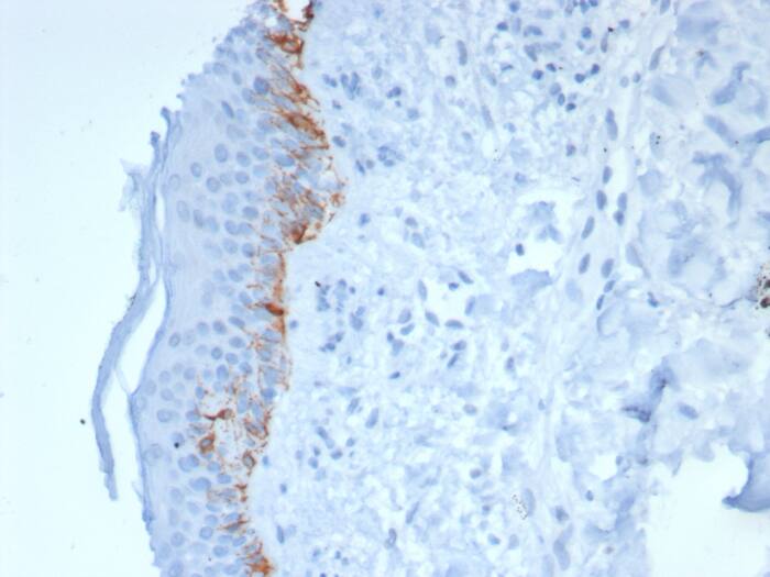 Formalin-fixed, paraffin-embedded human skin stained with Melan-A/MART-1 antibody (rMLANA/8180) - Azide and BSA Free. HIER: Tris/EDTA, pH9.0, 45min. Secondary: HRP-polymer, 30min. DAB, 5min.