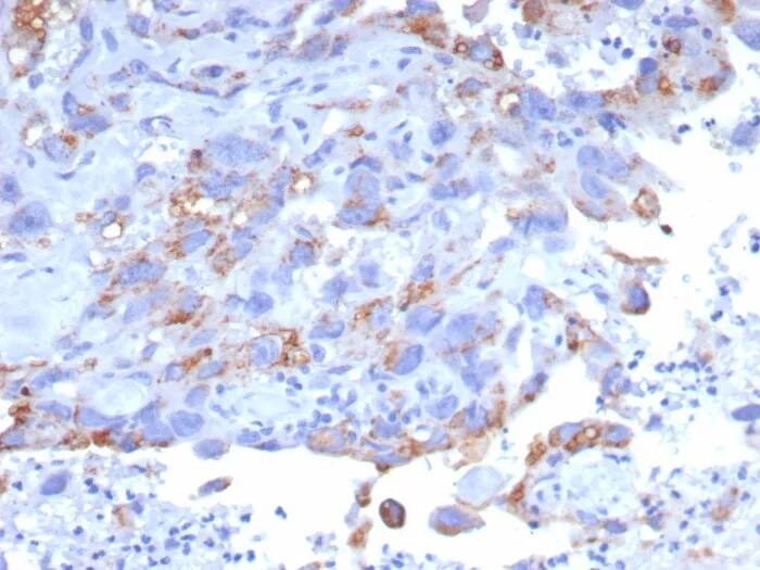 Immunohistochemistry-Paraffin: GPRC5A/RAI3 Antibody (GPRC5A/7893) - Azide and BSA Free [NBP3-24315] - Formalin-fixed, paraffin-embedded human bladder stained with GPRC5A/RAI3 Antibody (GPRC5A/7893). HIER: Tris/EDTA, pH9.0, 45min. 2°C: HRP-polymer, 30min. DAB, 5min.