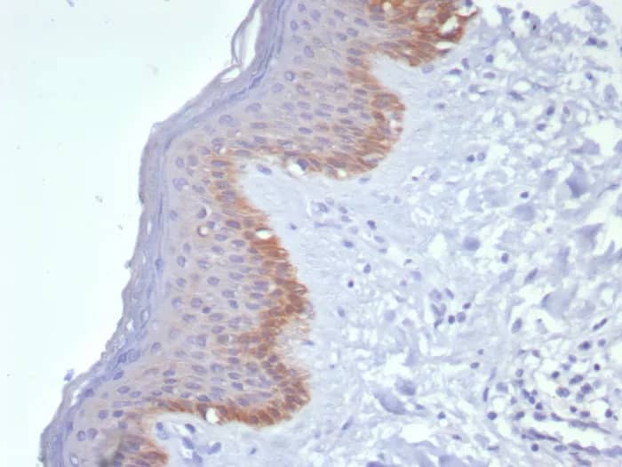 Immunohistochemistry-Paraffin: Cytokeratin 15 Antibody (KRT15/8312R) - Azide and BSA Free [NBP3-24320] - Formalin-fixed, paraffin-embedded human skin stained with Cytokeratin 15 Antibody (KRT15/8312R). HIER: Tris/EDTA, pH9.0, 45min. 2°C: HRP-polymer, 30min. DAB, 5min.