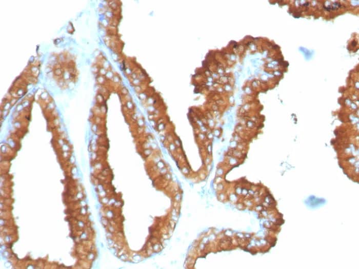Immunohistochemistry-Paraffin: CD63 Antibody (LAMP3/8248R) - Azide and BSA Free [NBP3-24325] - Formalin-fixed, paraffin-embedded human prostate stained with CD63 Antibody (LAMP3/8248R). HIER: Tris/EDTA, pH9.0, 45min. 2°C: HRP-polymer, 30min. DAB, 5min.