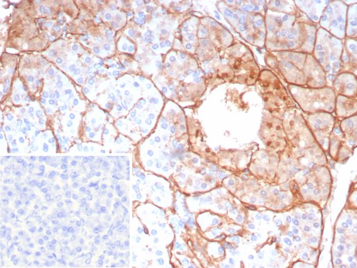 Formalin-fixed, paraffin-embedded human pancreas stained with Collagen IV alpha5 antibody (COL4A5/9396R) - Azide and BSA Free. Inset: PBS instead of primary antibody; secondary only negative control.