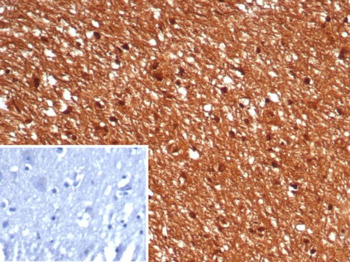 Formalin-fixed, paraffin-embedded human brain stained with GBX2 antibody (GBX2/7235) - Azide and BSA Free. Inset: PBS instead of primary antibody; secondary only negative control.