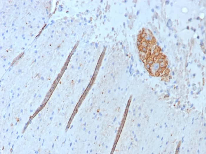 Immunohistochemistry-Paraffin: NCAM-1/CD56 Antibody (NCAM1/9074R) - Azide and BSA Free [NBP3-24334] - Formalin-fixed, paraffin-embedded human colon stained with NCAM-1/CD56 Antibody (NCAM1/9074R). HIER: Tris/EDTA, pH9.0, 45min. 2°C: HRP-polymer, 30min. DAB, 5min.