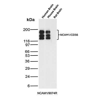 Western blot analysis of  Human Brain, Mouse Brain and Rat Brain tissue lysates using NCAM-1/CD56 Antibody (NCAM1/9074R) - Azide and BSA Free.