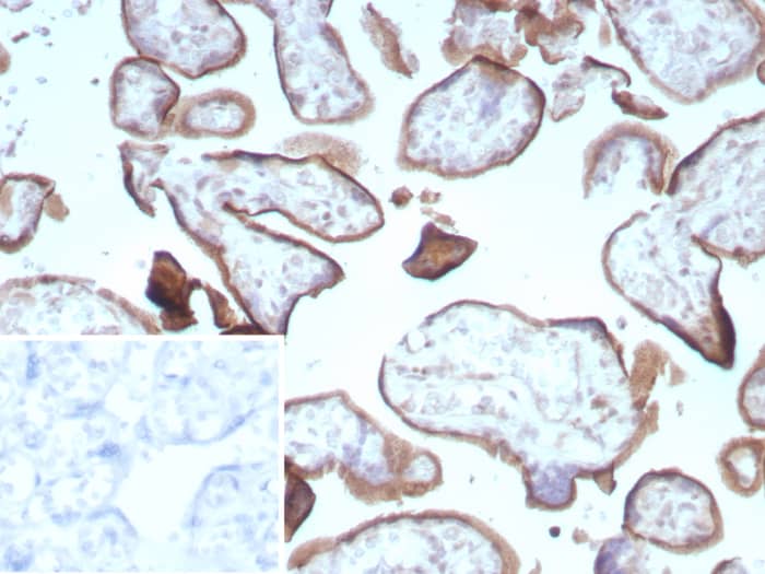 Formalin-fixed, paraffin-embedded human placenta stained with Endoglin/CD105 antibody (ENG/8961R) - Azide and BSA Free Inset: PBS instead of primary antibody; secondary only negative control.