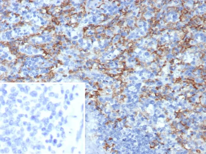 Immunohistochemistry-Paraffin: CD163L1 Antibody (CD163L1/7974) - Azide and BSA Free [NBP3-24337] - Formalin-fixed, paraffin-embedded human spleen stained with CD163L1 Antibody (CD163L1/7974). Inset: PBS instead of primary antibody; secondary only negative control.