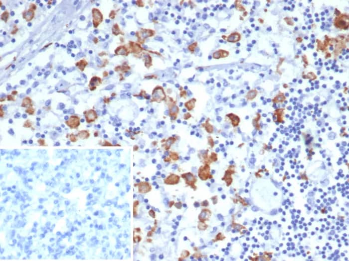 Immunohistochemistry-Paraffin: CD163L1 Antibody (CD163L1/7974) - Azide and BSA Free [NBP3-24337] - Formalin-fixed, paraffin-embedded human lymph node stained with CD163L1 Antibody (CD163L1/7974). Inset: PBS instead of primary antibody; secondary only negative control.