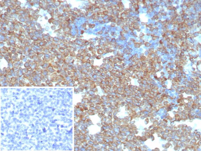Formalin-fixed, paraffin-embedded human tonsil stained with CD74 antibody (CLIP/8680R) - Azide and BSA Free. Inset: PBS instead of primary antibody; secondary only negative control.