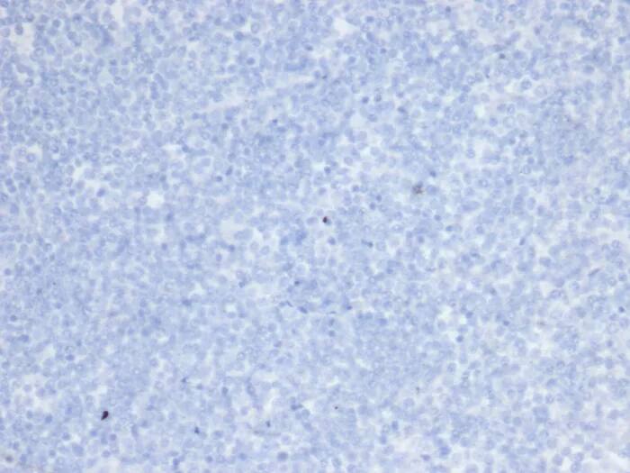 Immunohistochemistry-Paraffin: ErbB2/Her2 Antibody (rERBB2/6637) - Azide and BSA Free [NBP3-24341] - IHC analysis of formalin-fixed, paraffin-embedded human brain. Negative tissue control using ErbB2/Her2 Antibody (rERBB2/6637) at 2ug/ml in PBS for 30min RT. HIER: Tris/EDTA, pH9.0, 45min. 2°C: HRP-polymer, 30min. DAB, 5min.