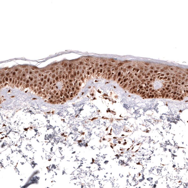 Staining of human skin shows strong nuclear positivity in squamous epithelial cells.