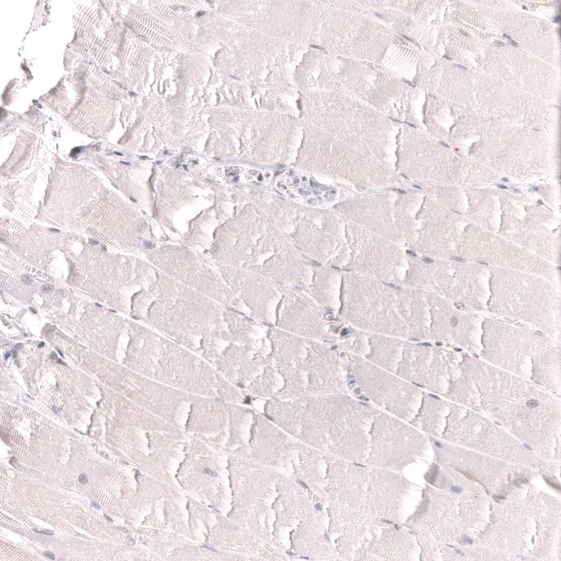 Staining of human skeletal muscle shows no positivity in myocytes as expected.