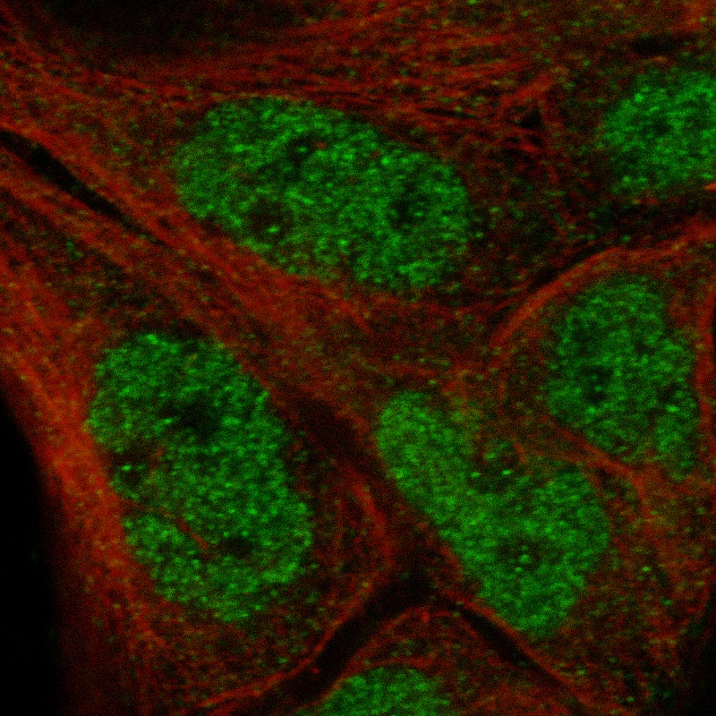 Staining in EFO-21 cell line with Anti-IL33 monoclonal antibody, showing specific staining of nucleoplasm in green. Microtubule- and nuclear probes are visualized in red and blue respectively (where available).