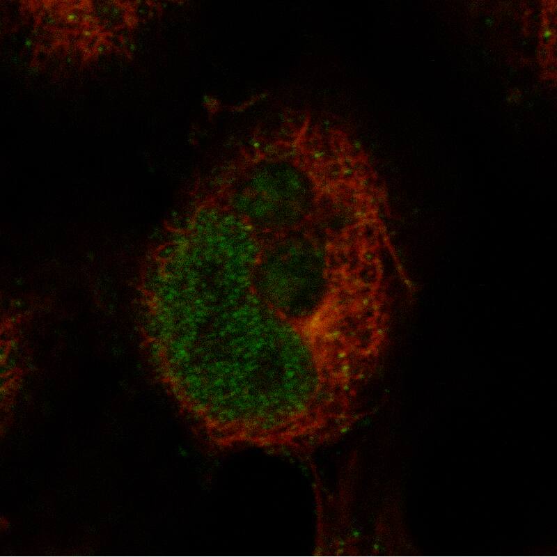Staining in NTERA-2 cell line with Anti-BCL11A monoclonal antibody, showing specific staining of nucleoplasm in green. Microtubule- and nuclear probes are visualized in red and blue respectively (where available).