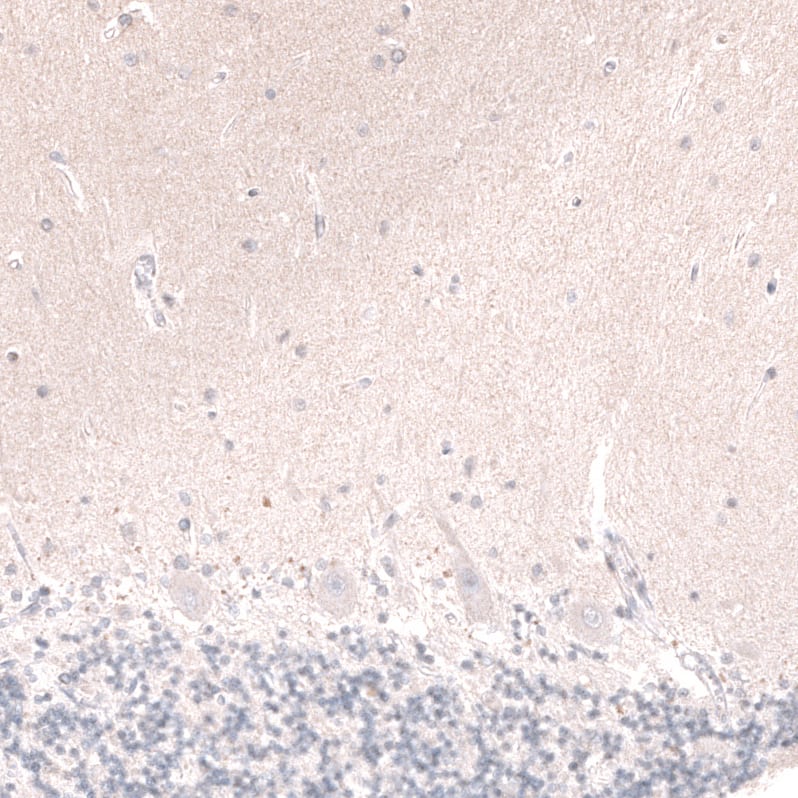 Staining of human cerebellum shows no positivity in Purkinje cells as expected.