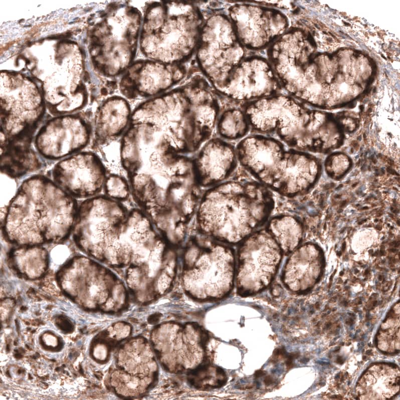 Staining of human salivary gland shows moderate cytoplasmic positivity in glandular cells.