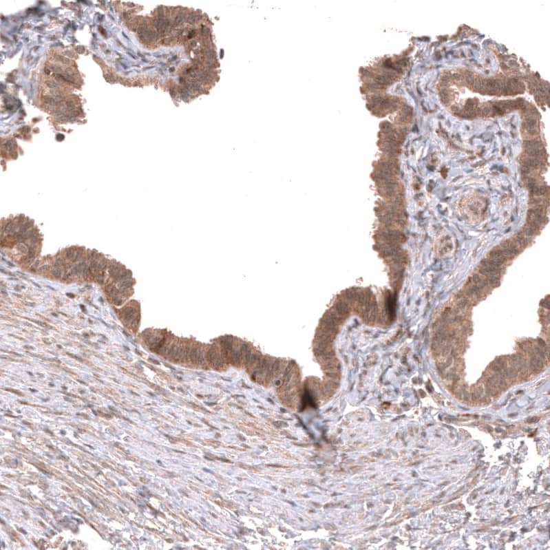 Staining of human fallopian tube shows moderate cytoplasmic positivity in glandular cells.