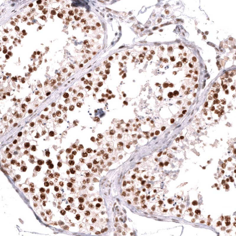 Staining of human testis shows strong nuclear positivity in cells in seminiferous ducts.