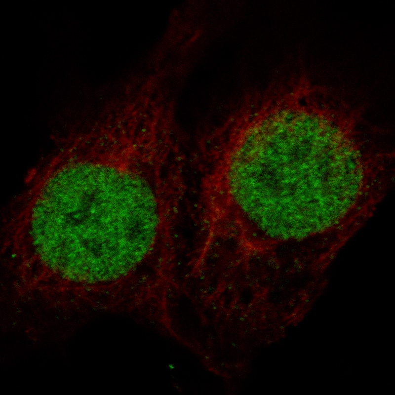 Staining in NTERA-2 cell line with Anti-MSH2 monoclonal antibody, showing specific staining of nucleoplasm in green. Microtubule- and nuclear probes are visualized in red and blue respectively (where available).