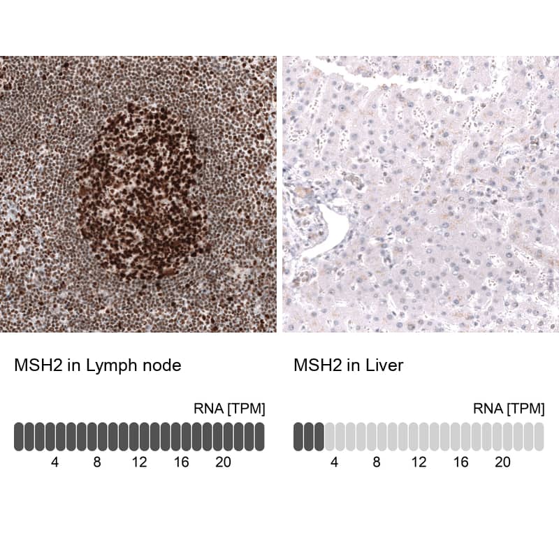 <b>Orthogonal Strategies Validation. </b>Analysis in human lymph node and liver tissues using NBP3-24573 antibody. Corresponding MSH2 RNA-seq data are presented for the same tissues.