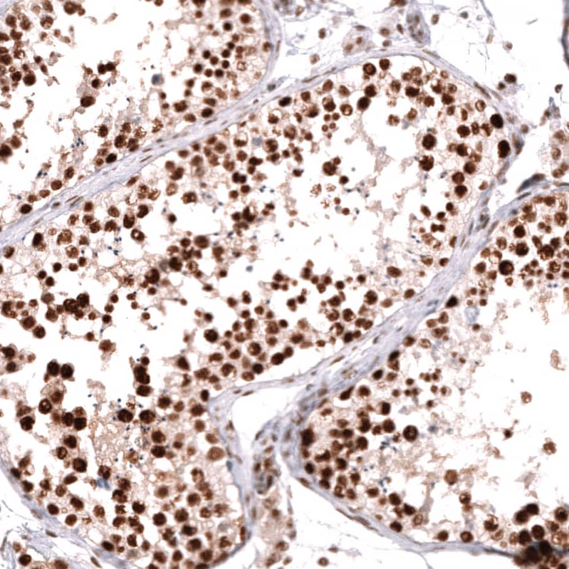 Staining of human testis shows strong nuclear positivity in cells in seminiferous ducts.