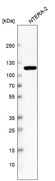 Western blot analysis in human cell line NTERA-2.