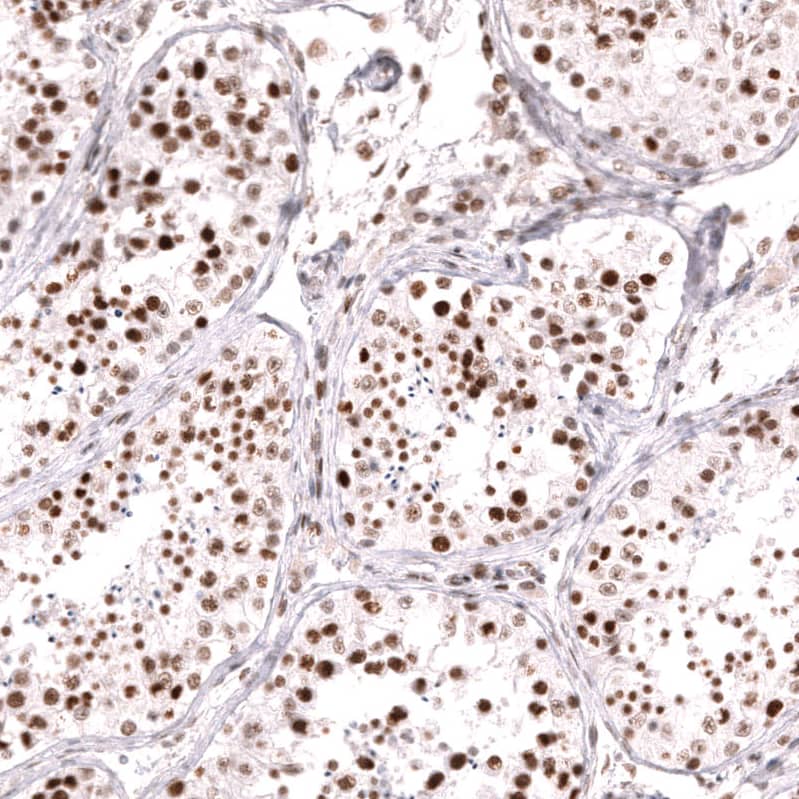 Staining of human testis shows strong nuclear positivity in cells in seminiferous ducts.