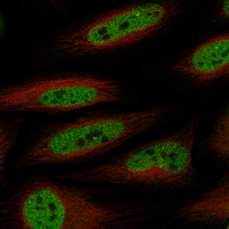 Staining in HeLa cell line with Anti-SMARCA4 monoclonal antibody, showing specific staining of nucleoplasm and nuclear bodies in green. Microtubule- and nuclear probes are visualized in red and blue respectively (where available).