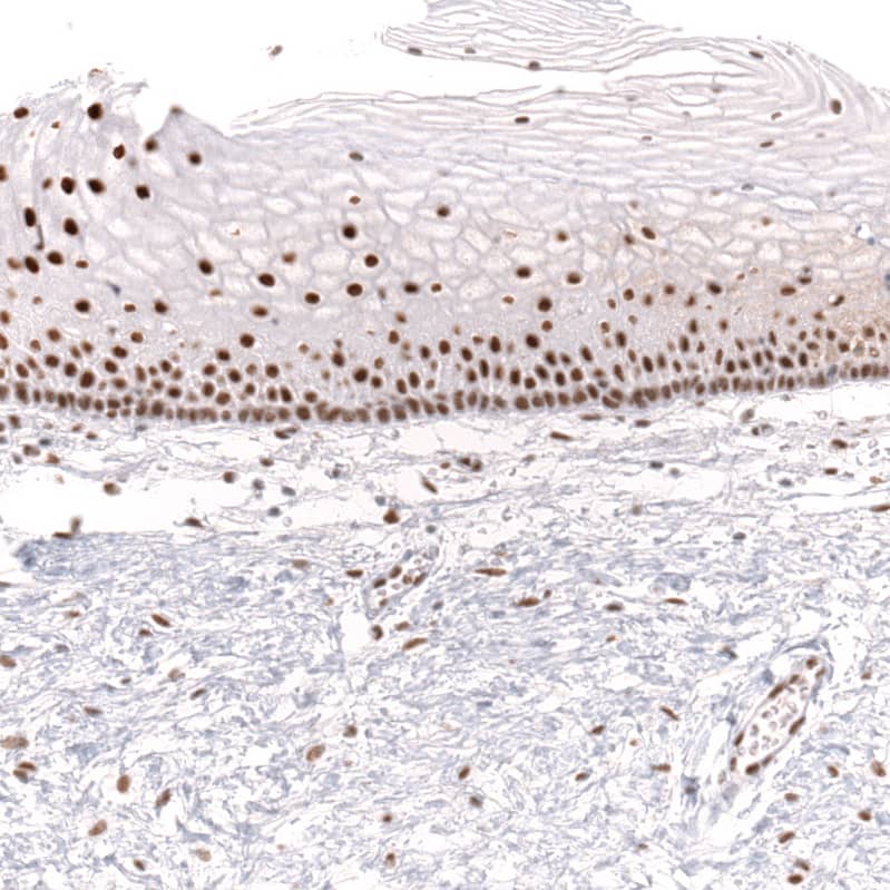 Staining of human uterine cervix shows strong nuclear positivity in squamous epithelial cells.