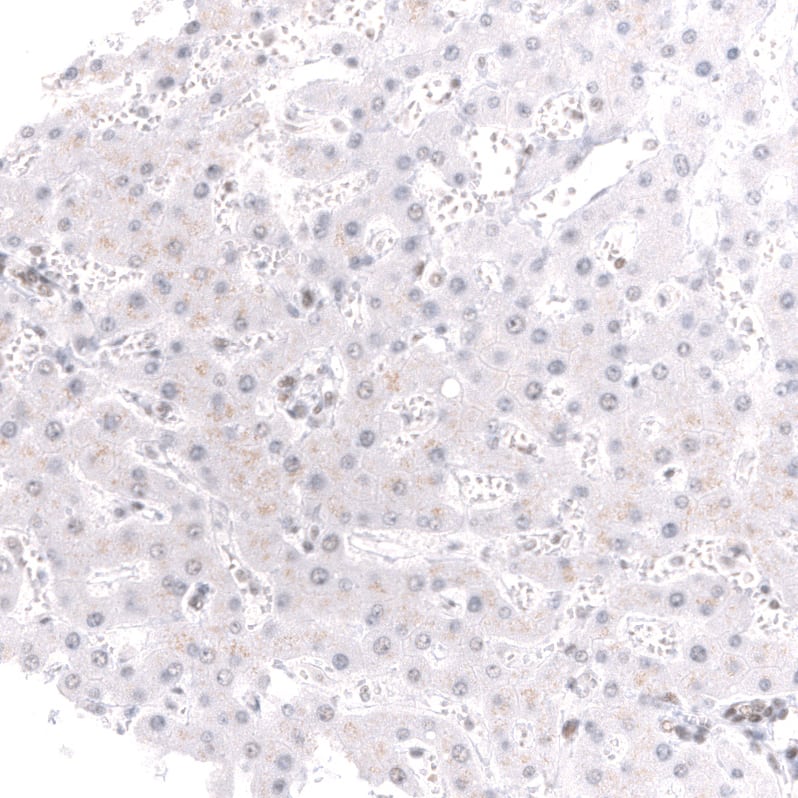 Staining of human liver shows no positivity in hepatocytes as expected.