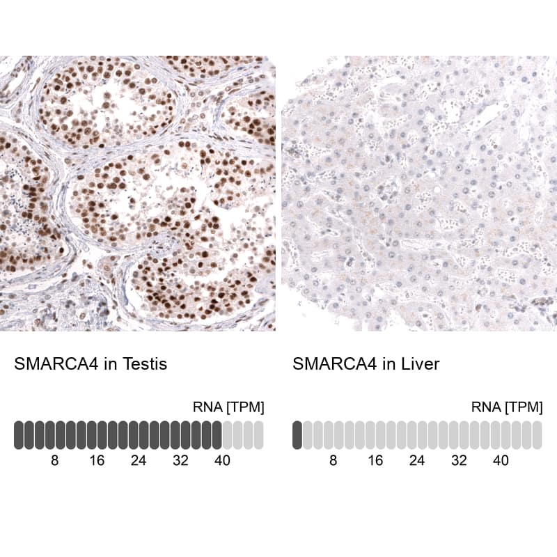 <b>Orthogonal Strategies Validation. </b>Analysis in human testis and liver tissues using NBP3-24576 antibody. Corresponding SMARCA4 RNA-seq data are presented for the same tissues.