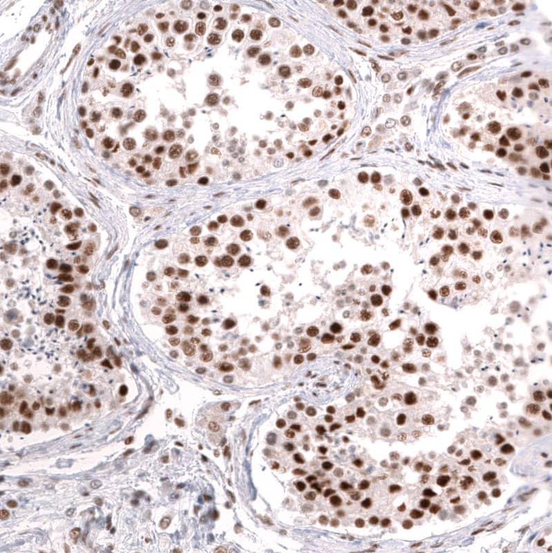 Staining of human testis shows strong nuclear positivity in cells in seminiferous ducts.