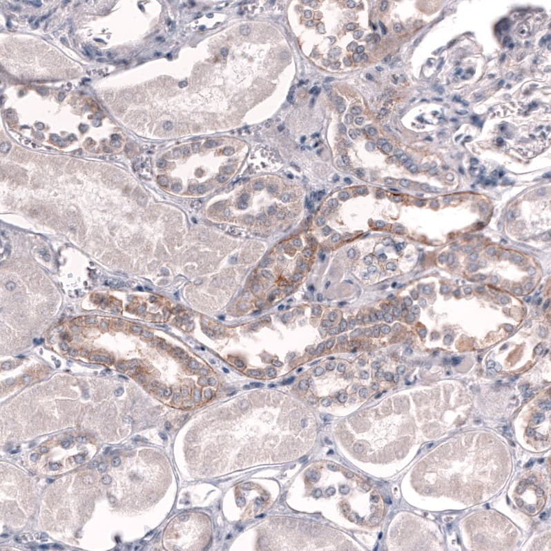 Staining of human kidney shows weak to moderate membranous positivity in cells in tubules.