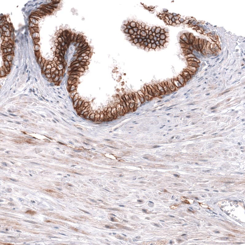 Staining of human prostate shows strong membranous positivity in glandular cells.