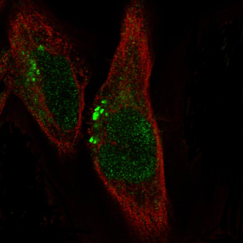 Staining in RH-30 cell line with Anti-ADAM10 monoclonal antibody, showing specific staining of Golgi apparatus and nucleus in green. Microtubule- and nuclear probes are visualized in red and blue respectively (where available).