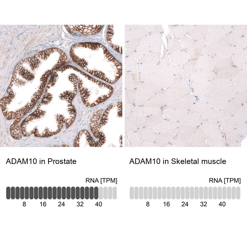 <b>Orthogonal Strategies Validation. </b>Analysis in human prostate and skeletal muscle tissues using NBP3-24579 antibody. Corresponding ADAM10 RNA-seq data are presented for the same tissues.