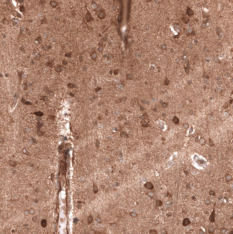 Staining of human cerebral cortex shows moderate to strong cytoplasmic positivity in neurons.