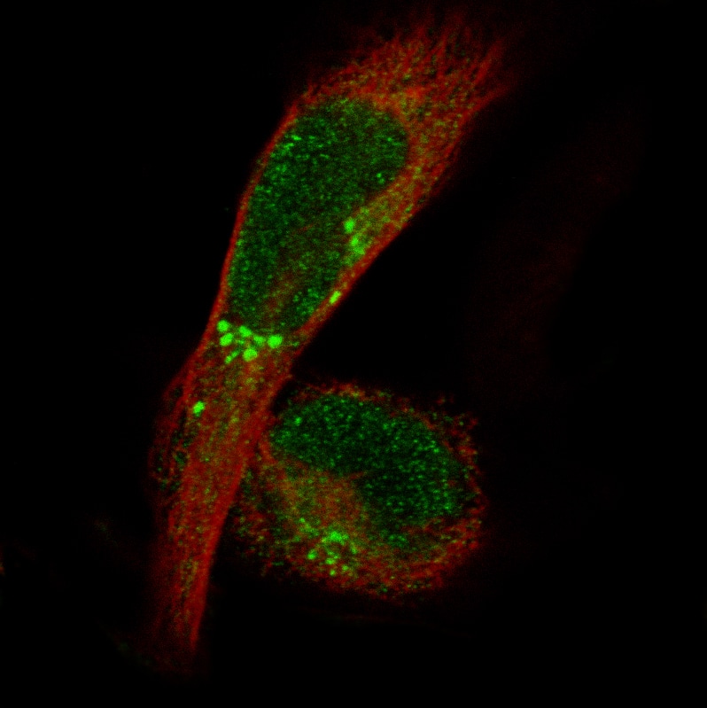 Staining in RH-30 cell line with Anti-ADAM10 monoclonal antibody, showing specific staining of Golgi apparatus and nucleus in green. Microtubule- and nuclear probes are visualized in red and blue respectively (where available).