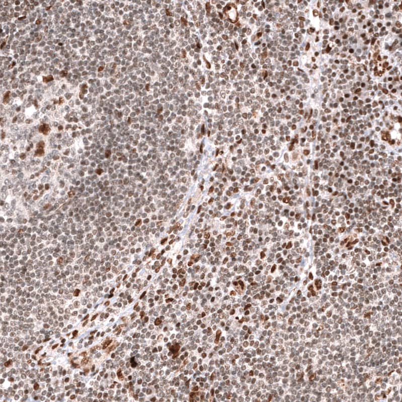 Staining of human lymph node shows moderate nuclear positivity in non-germinal center cells.