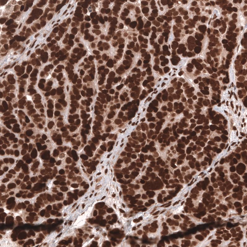 Immunohistochemistry-Paraffin BCOR Antibody (CL13841)