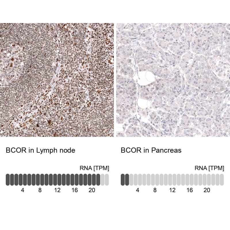 Immunohistochemistry-Paraffin BCOR Antibody (CL13841)