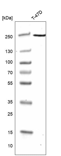 Western blot analysis in human cell line TD47D.