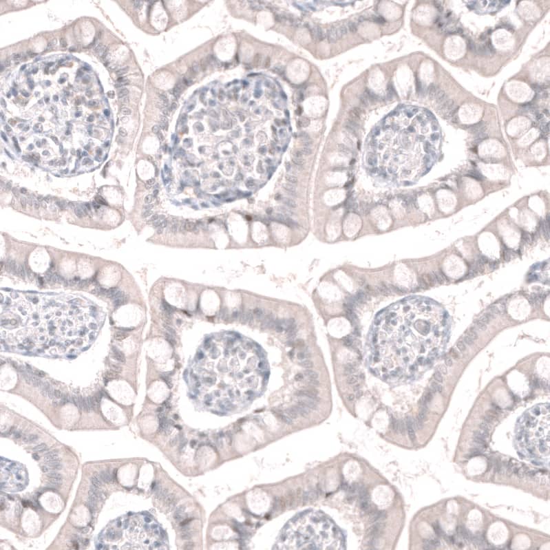 Staining of human small intestine shows no positivity in glandular cells as expected.