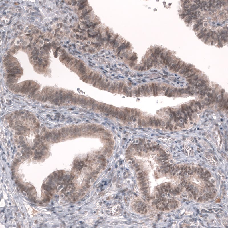 Staining of human fallopian tube shows weak to moderate cytoplasmic and nuclear positivity in glandular cells.