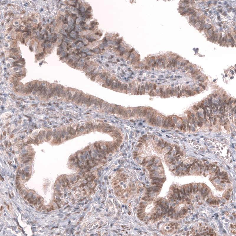 Staining of human fallopian tube shows weak to moderate cytoplasmic and nuclear positivity in glandular cells.