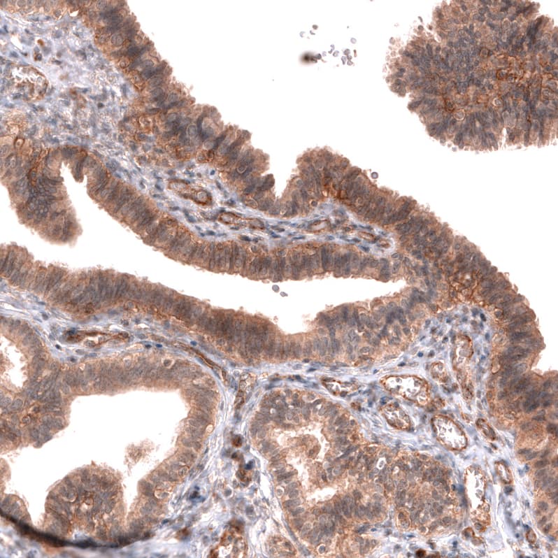 Staining of human fallopian tube shows moderate membranous and cytoplasmic positivity in glandular cells.