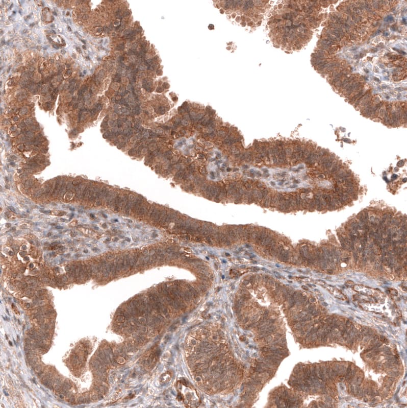 Staining of human fallopian tube shows moderate membranous and cytoplasmic positivity in glandular cells.