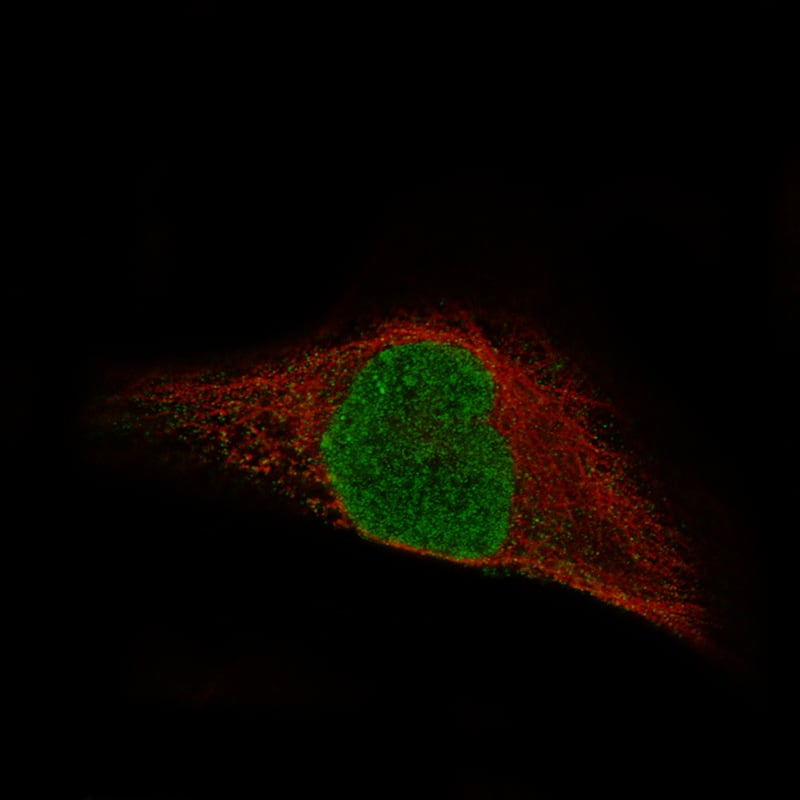 Staining in RH-30 cell line with Anti-MSH3 monoclonal antibody, showing specific staining of nucleoplasm and nucleus in green. Microtubule- and nuclear probes are visualized in red and blue respectively (where available).