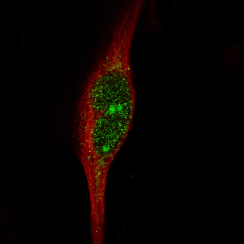 Staining in RH-30 cell line with Anti-MSH3 monoclonal antibody, showing specific staining of nucleoplasm and nucleus and nucleoli in green. Microtubule- and nuclear probes are visualized in red and blue respectively (where available).